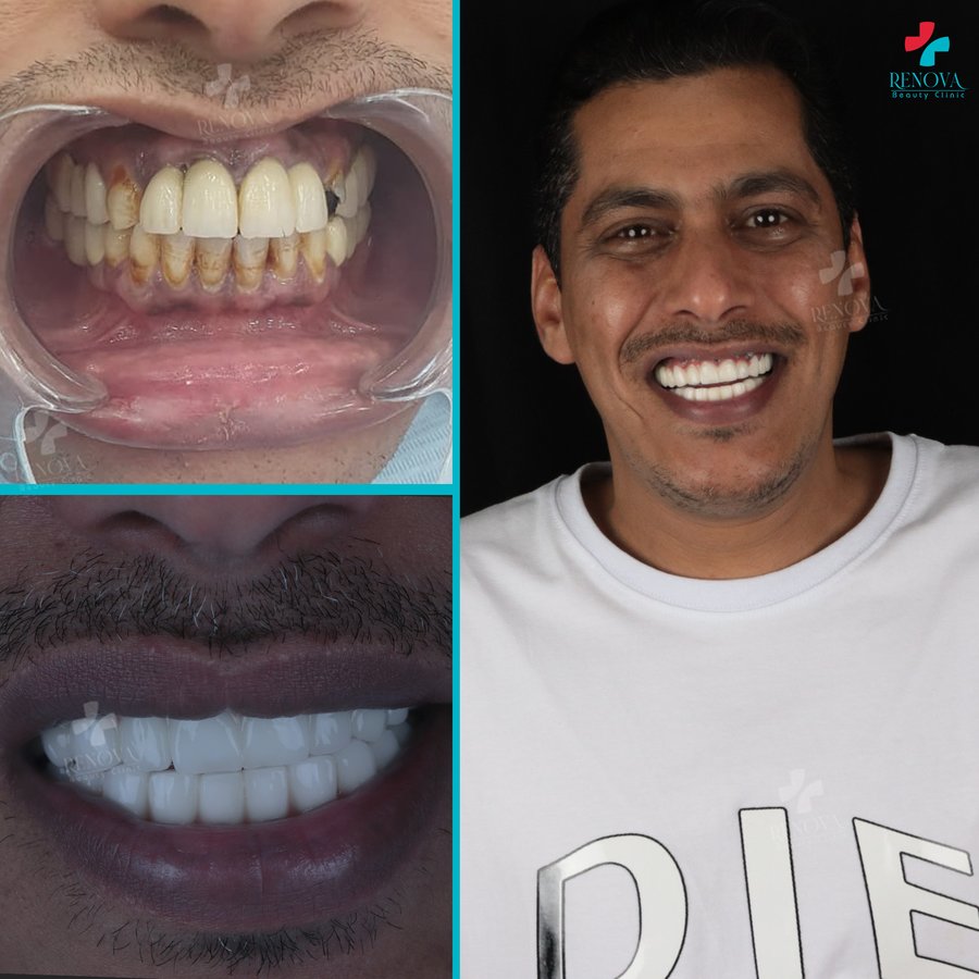 Renova Dental - Renova Dental