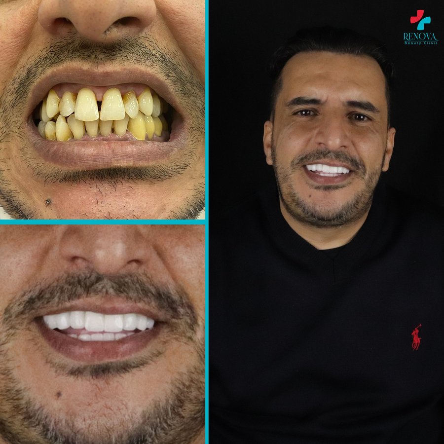 Renova Dental - Renova Dental