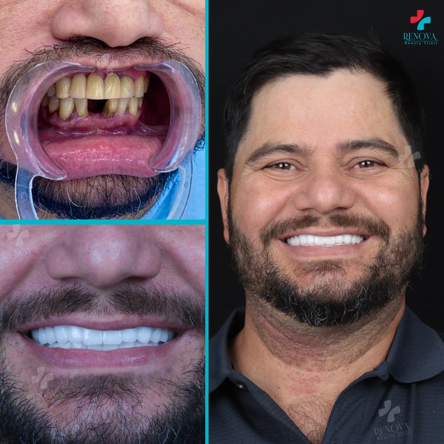 Renova Dental - Renova Dental