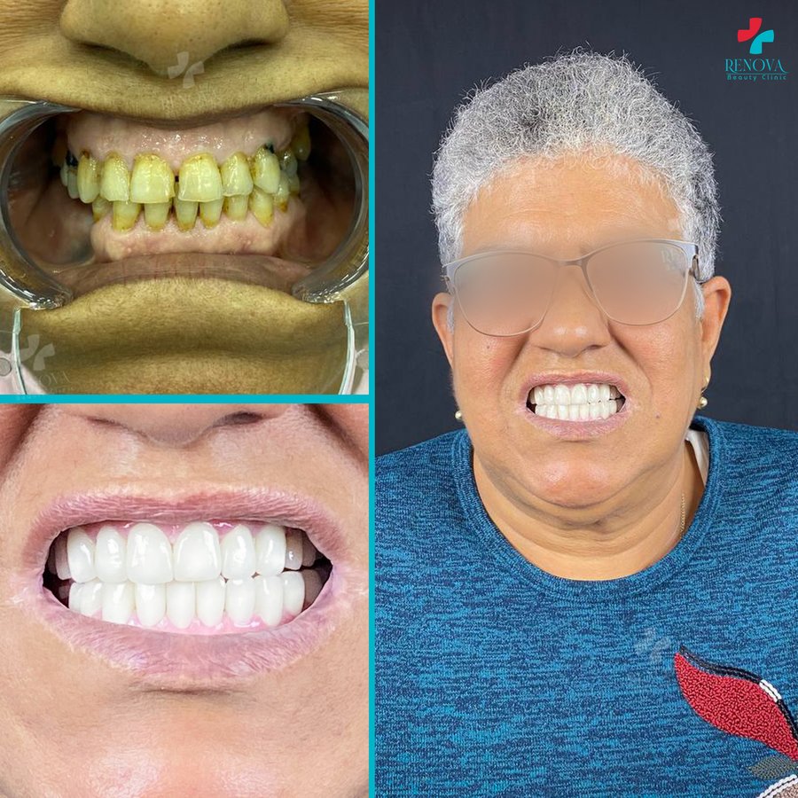 Renova Dental - Renova Dental