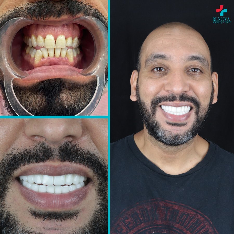 Renova Dental - Renova Dental