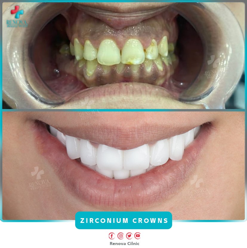 Renova Dental - Renova Dental