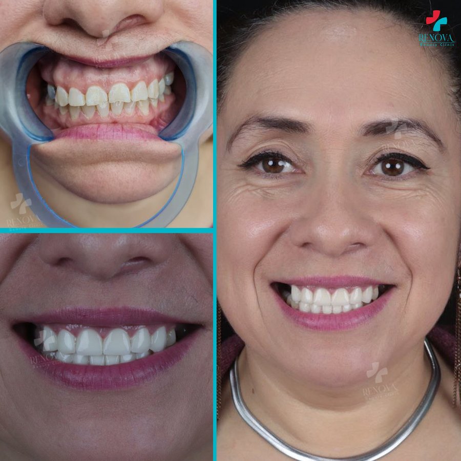 Renova Dental - Renova Dental