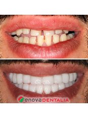 Renova Dental - Renova Dental