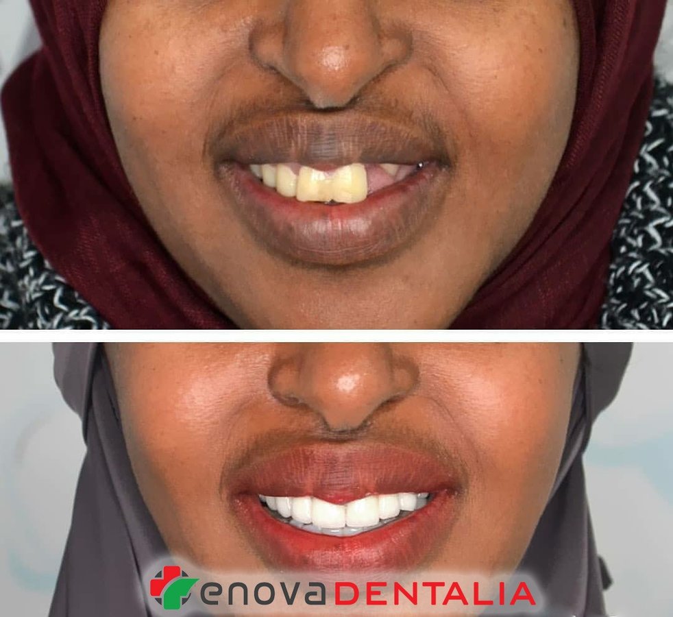 Renova Dental - Renova Dental