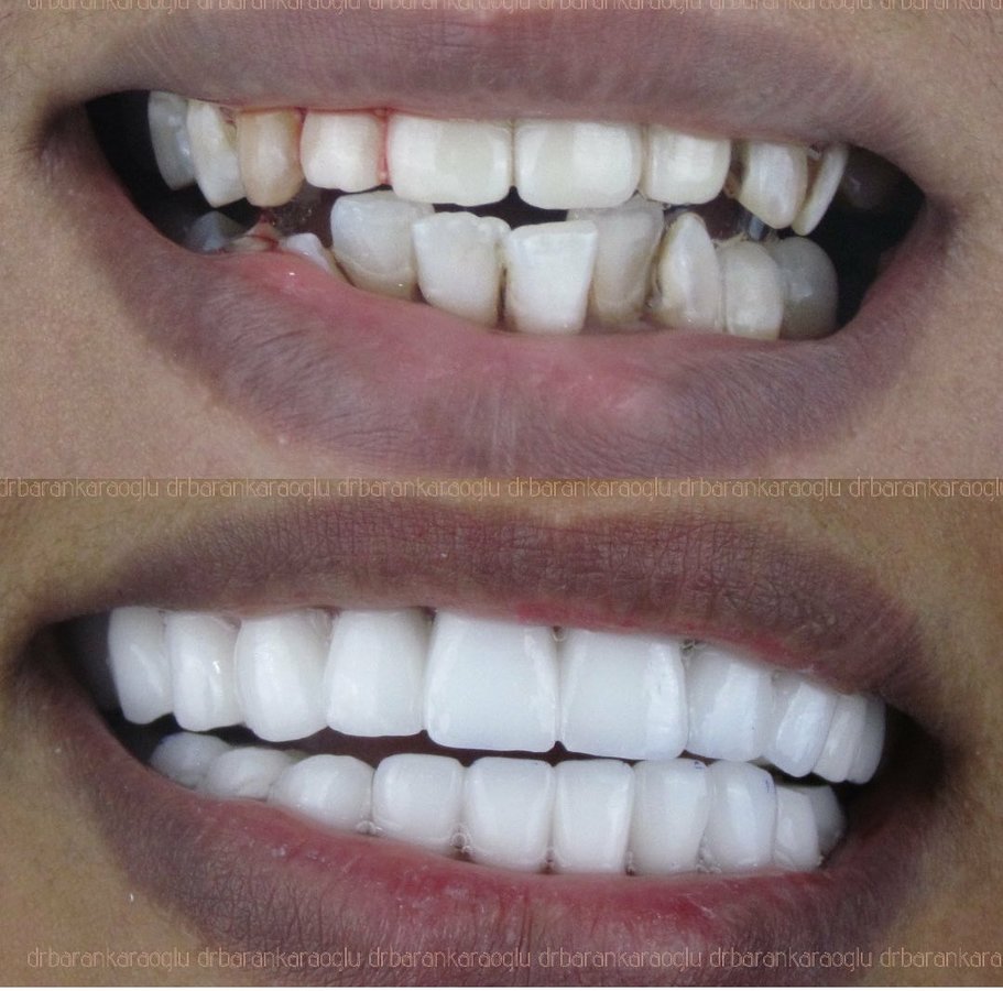 Renova Dental - Renova Dental