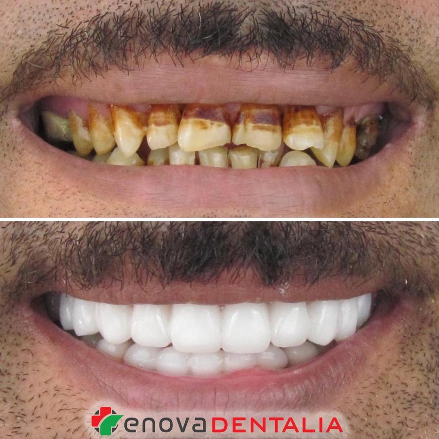 Renova Dental - Renova Dental