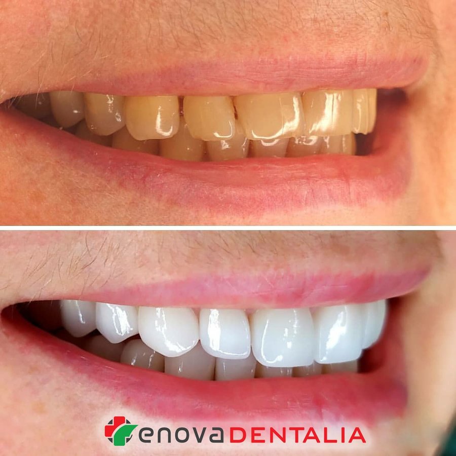 Renova Dental - Renova Dental