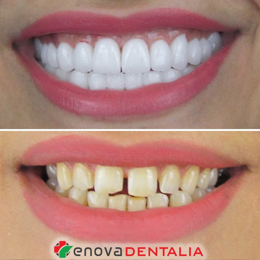 Renova Dental - Renova Dental