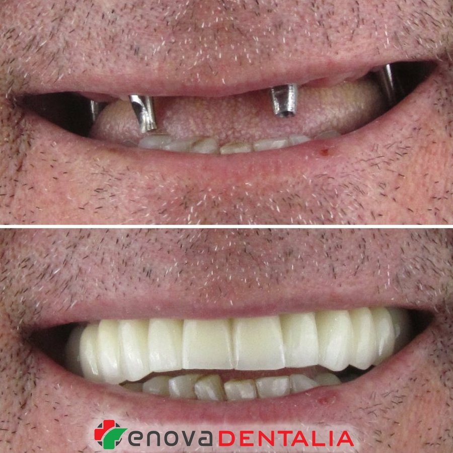 Renova Dental - Renova Dental