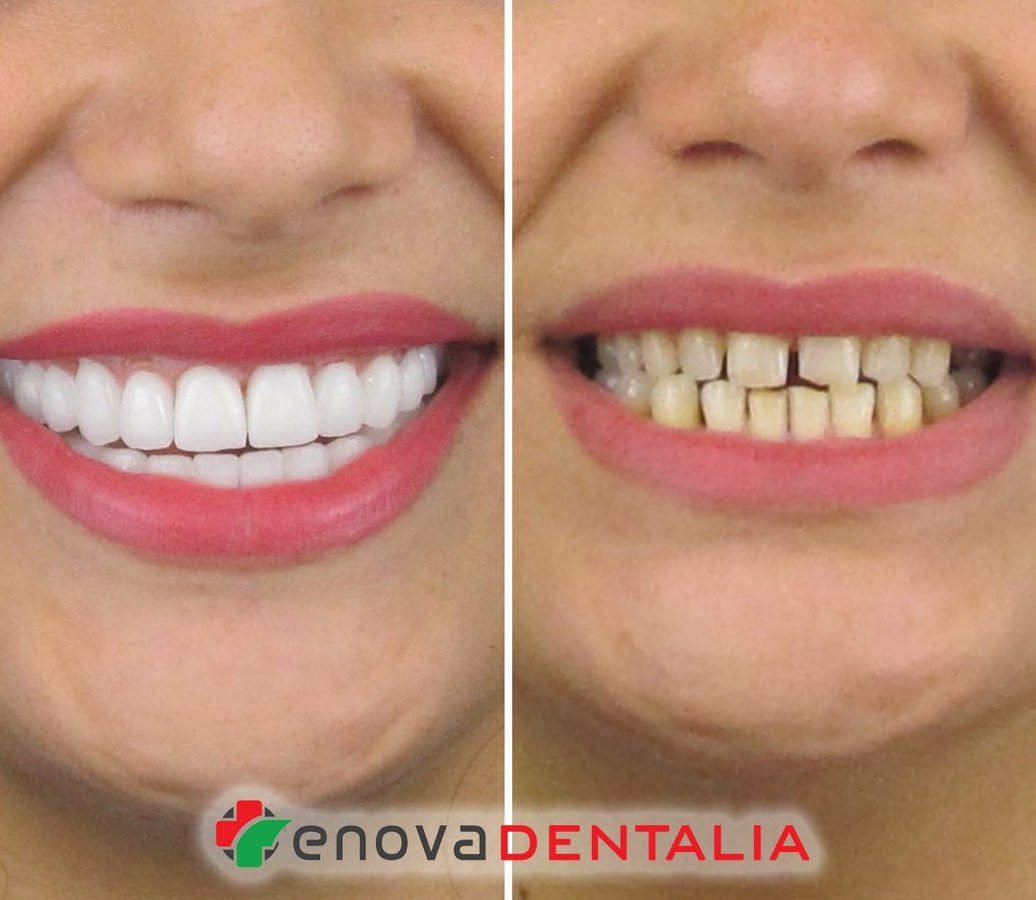 Renova Dental - Renova Dental