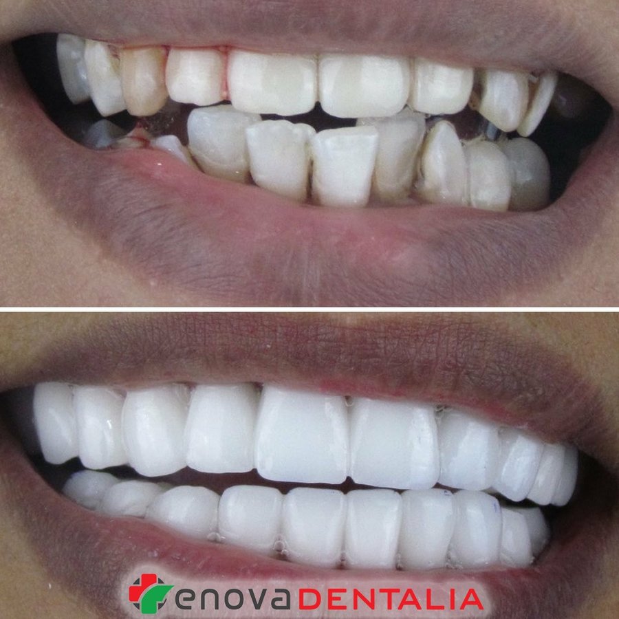 Renova Dental - Renova Dental
