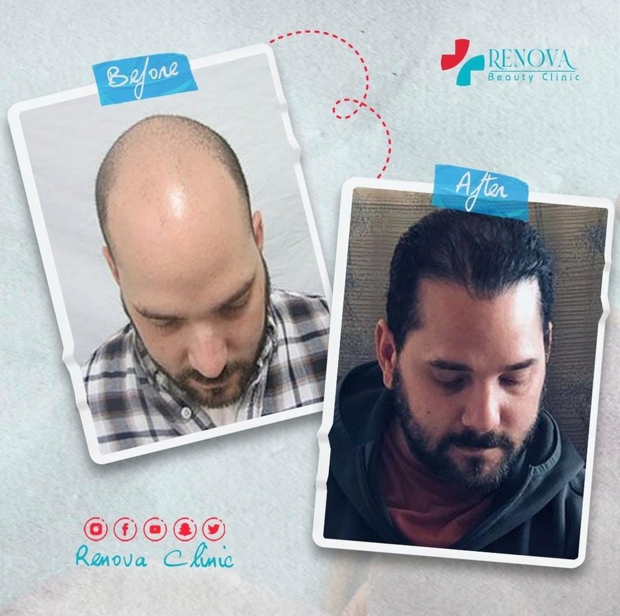 عيادة رينوفا - Renovaa Clinic