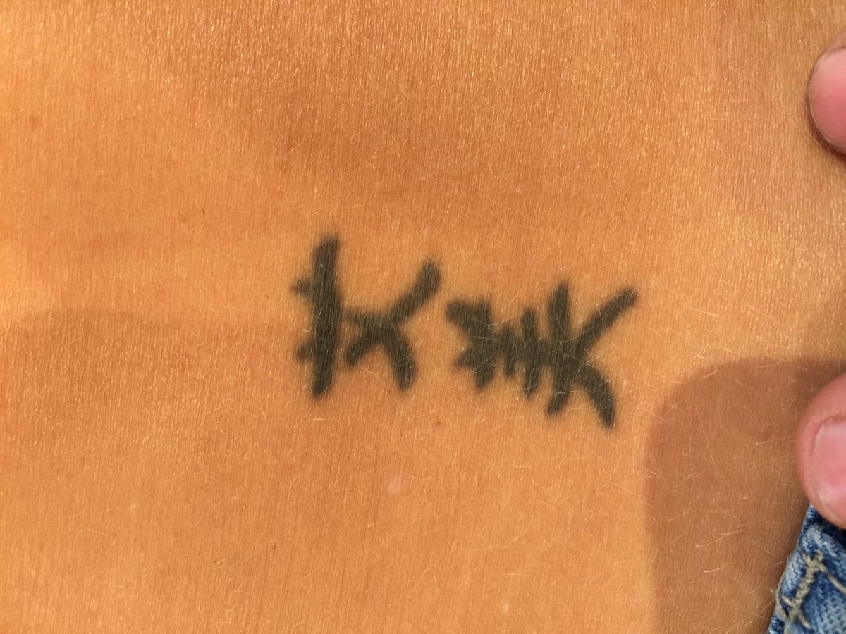 ReThink إزالة الوشم بالليزر - ReThink Laser Tattoo Removal