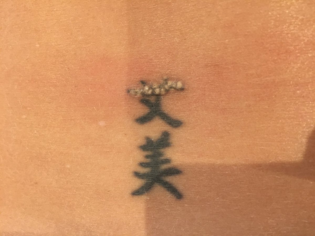 ReThink إزالة الوشم بالليزر - ReThink Laser Tattoo Removal