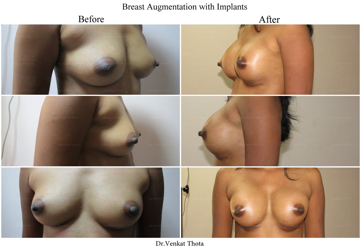 Revera Cosmetic Surgery & LASER Centre - Revera Cosmetic Surgery & LASER Centre