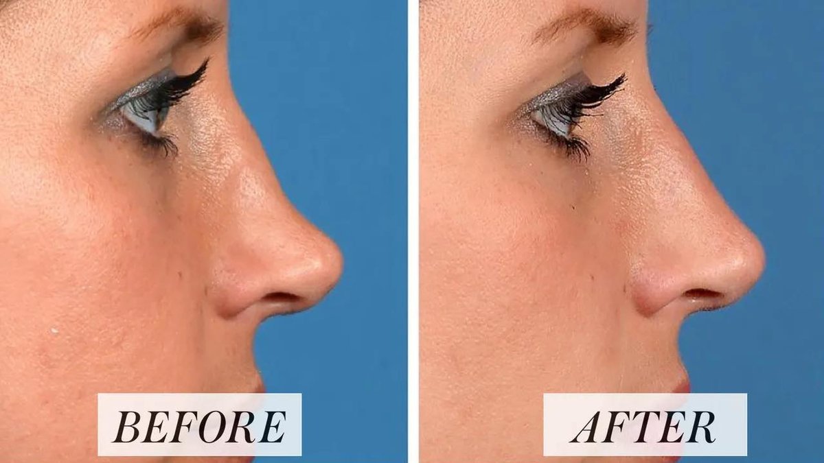Revitalize Medical Aesthetics - Revitalize Medical Aesthetics