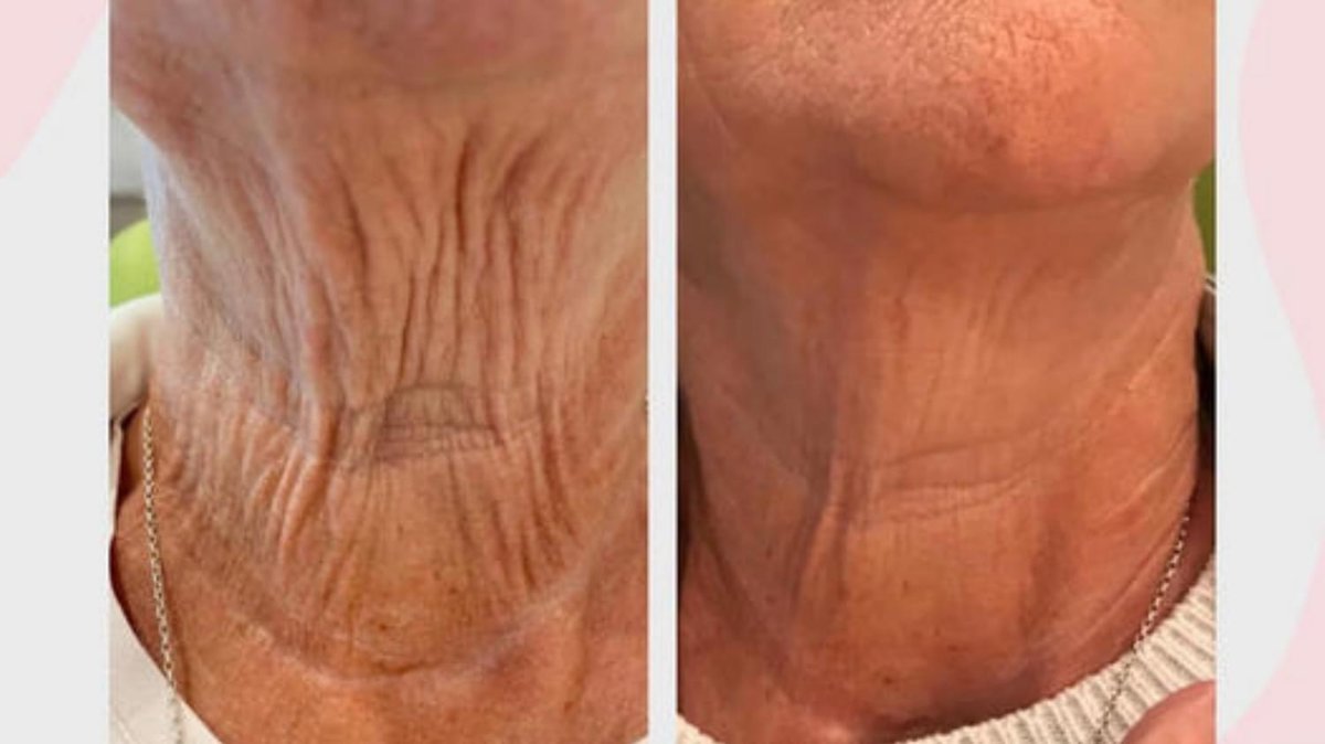 Revitalize Medical Aesthetics - Revitalize Medical Aesthetics