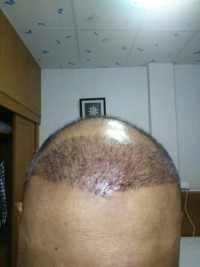 Revive Aesthetic Clinic- Bangalore - Revive Aesthetic Clinic- Bangalore