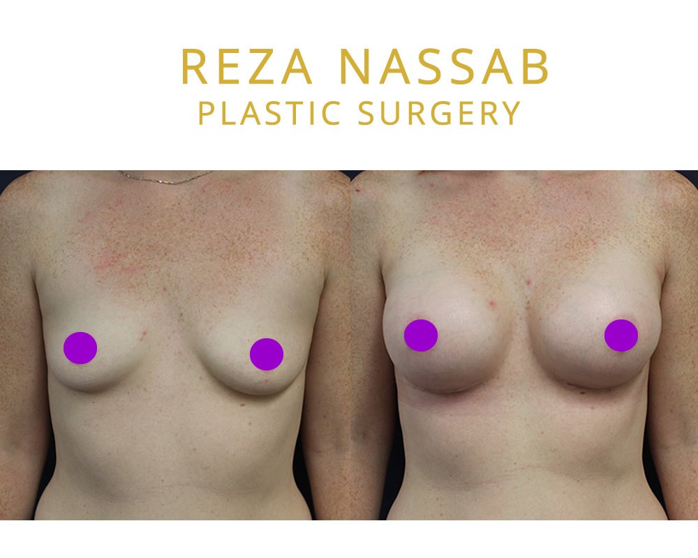 Reza Nassab Plastic Surgery - Reza Nassab Plastic Surgery