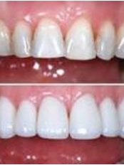 RG's SMILE ZONE & IMPLANT CENTRE - RG's SMILE ZONE & IMPLANT CENTRE