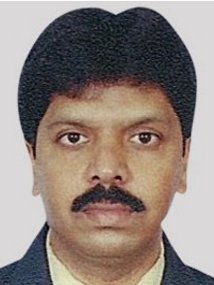 Rhinoplasty Bangalore - Rhinoplasty Bangalore