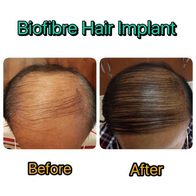 Rinrada Cosmetic & Plastic Surgery Clinic Pattaya - Rinrada Cosmetic & Plastic Surgery Clinic Pattaya