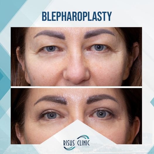 Risus Clinic - Risus Clinic