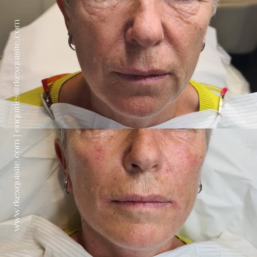 RK Exquisite - RK Exquisite