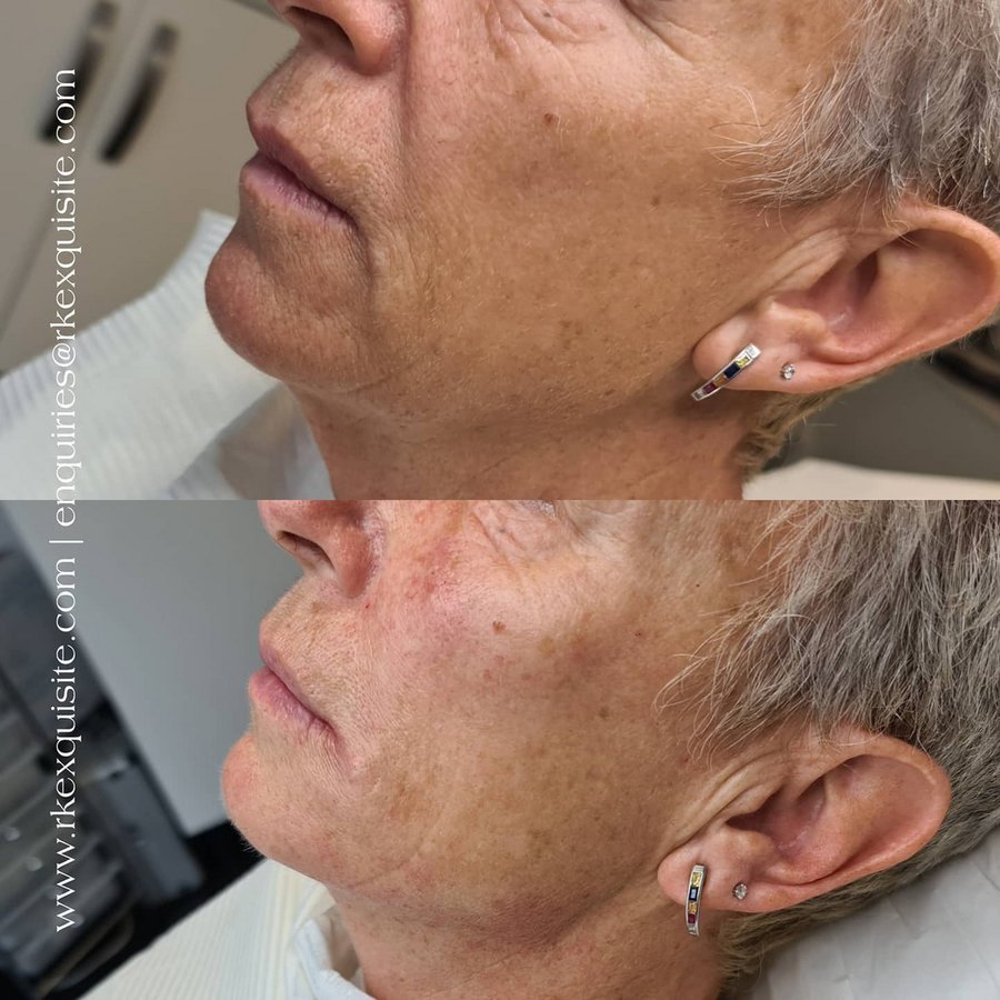 RK Exquisite - RK Exquisite