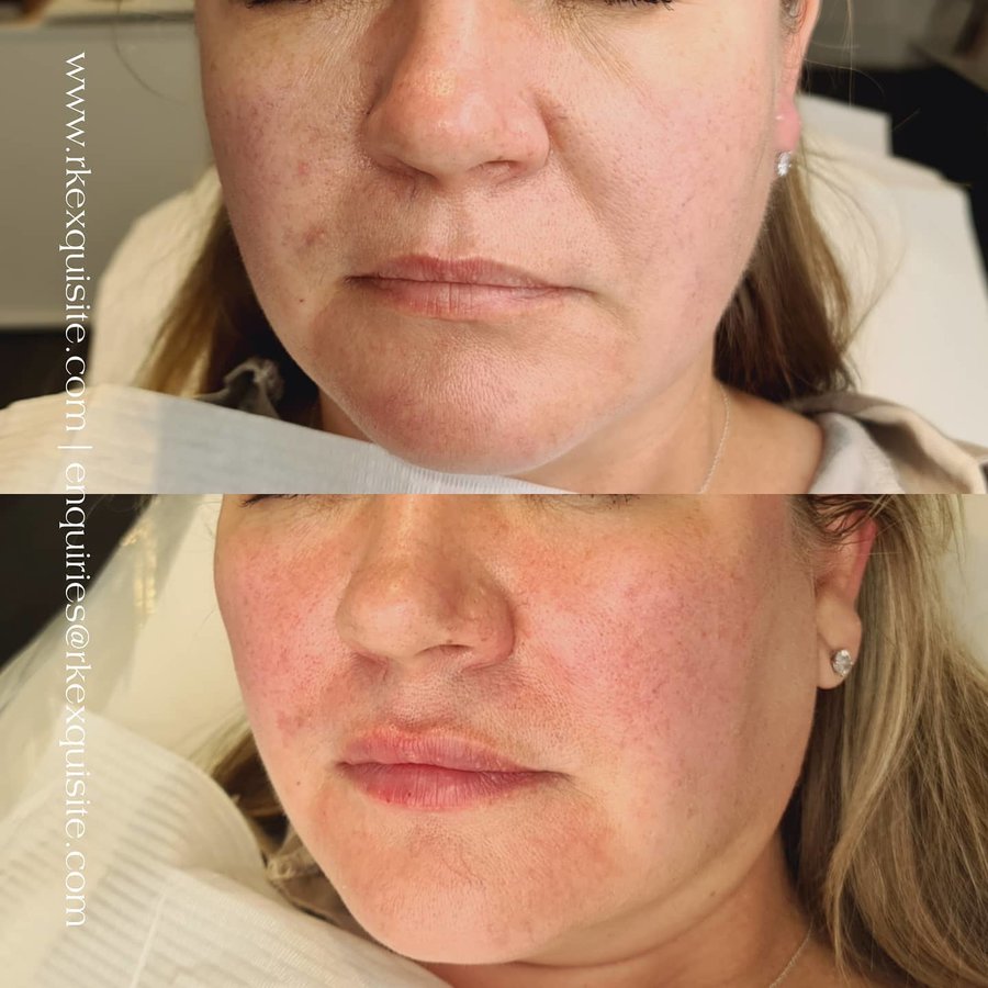 RK Exquisite - RK Exquisite