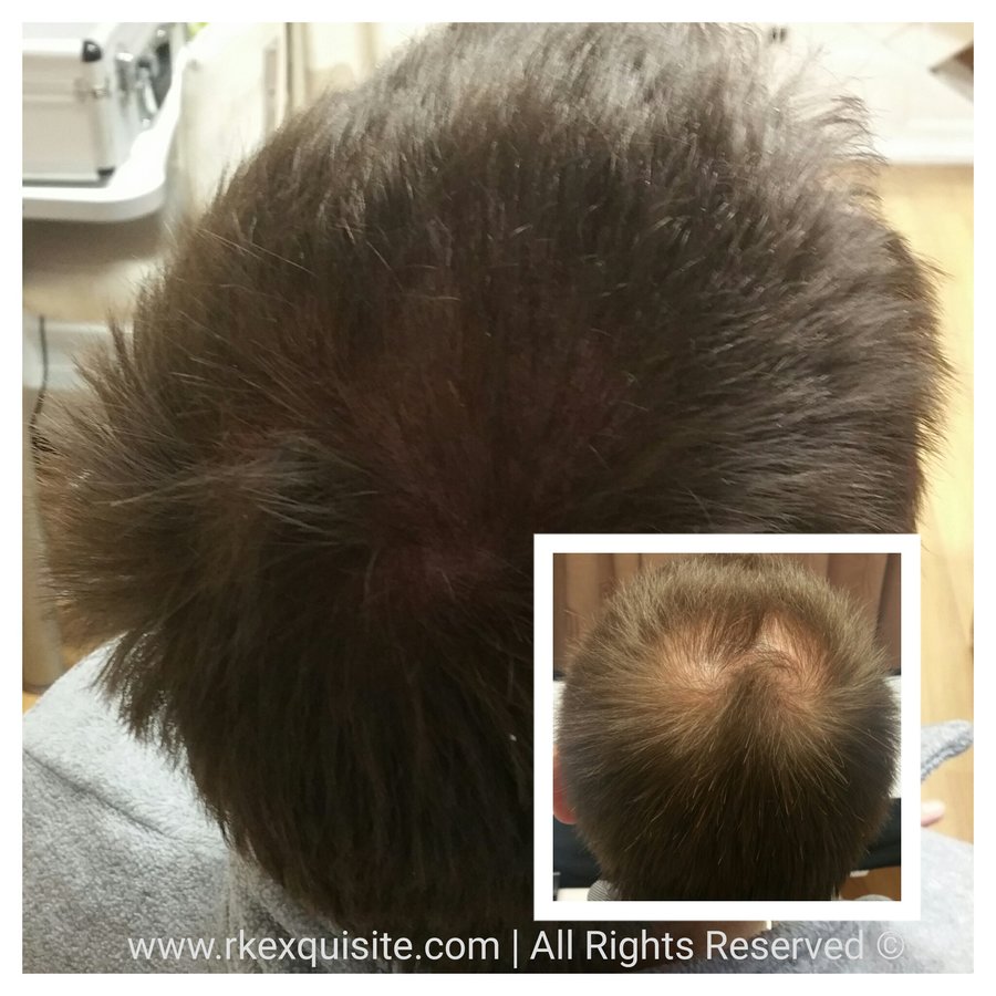 RK Exquisite - RK Exquisite