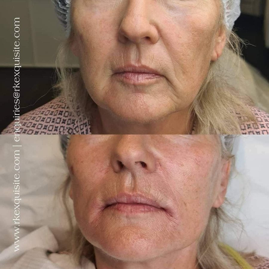 RK Exquisite - RK Exquisite