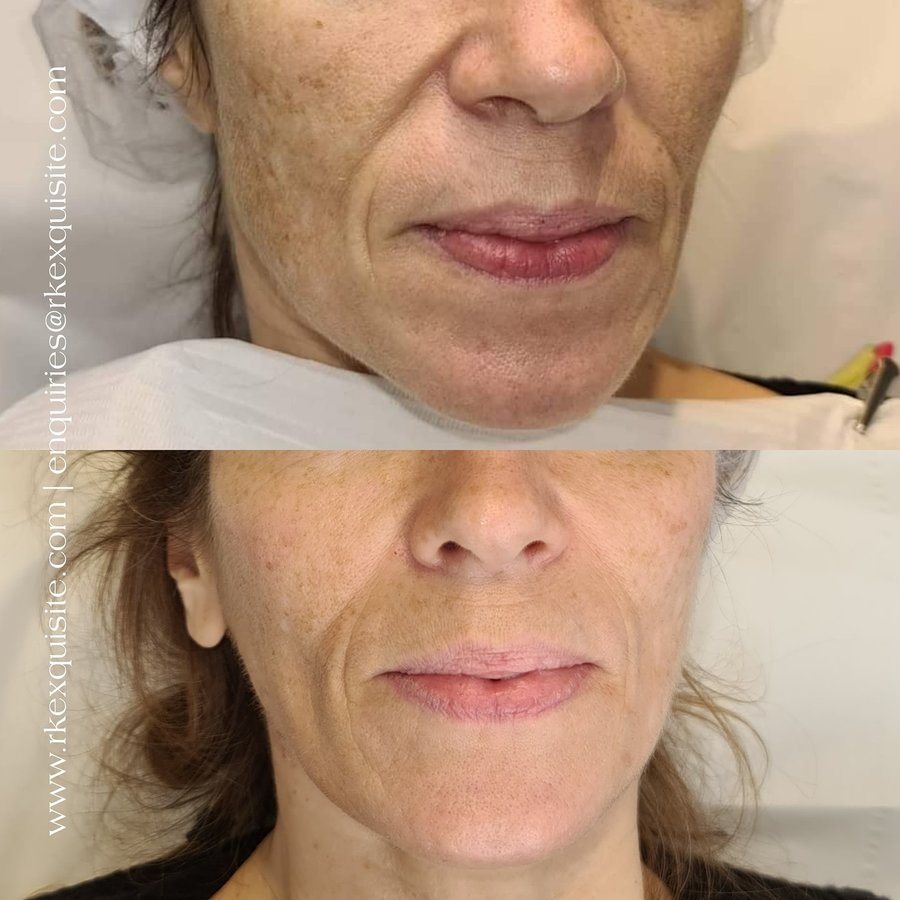 RK Exquisite - RK Exquisite