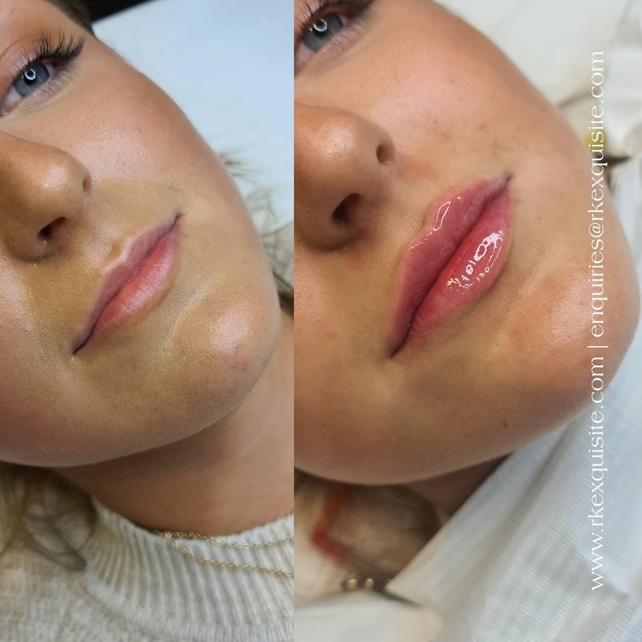 RK Exquisite - RK Exquisite