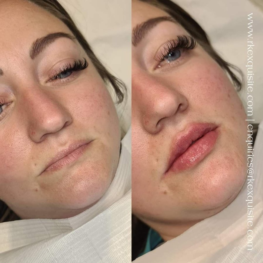 RK Exquisite - RK Exquisite