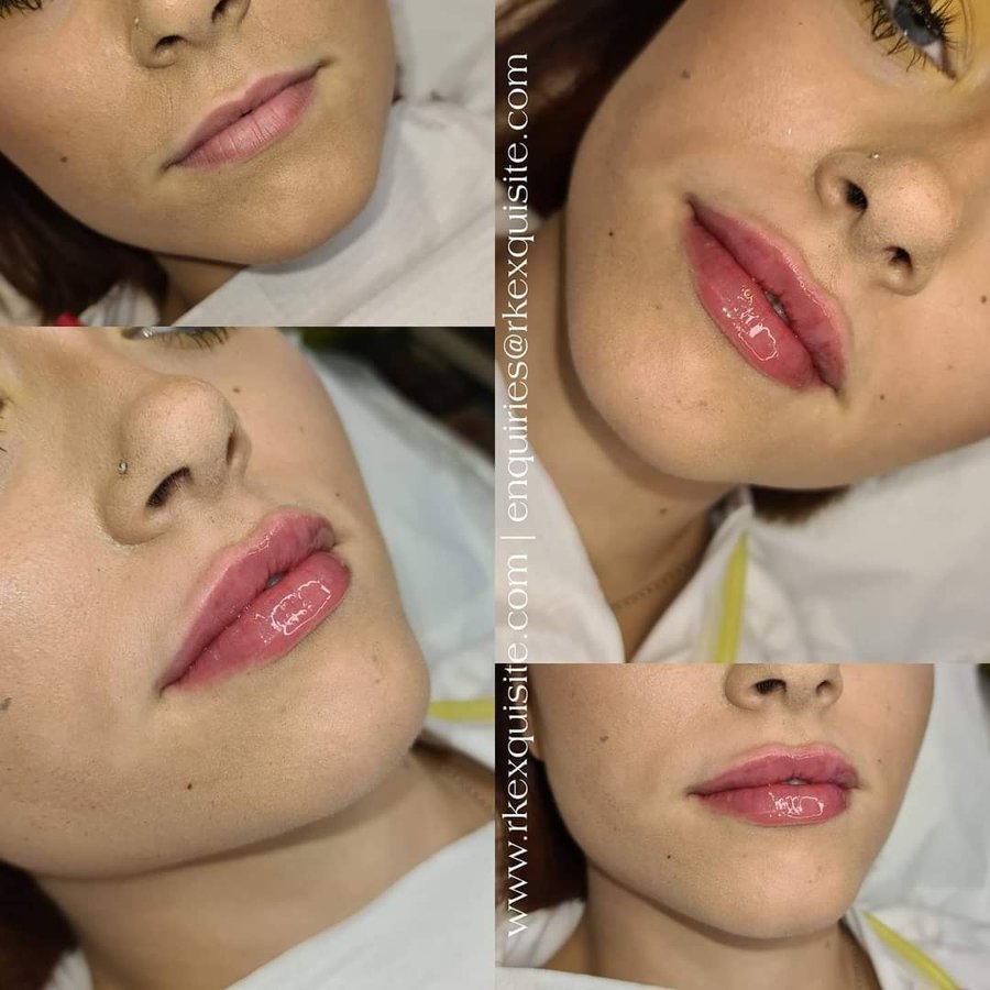 RK Exquisite - RK Exquisite