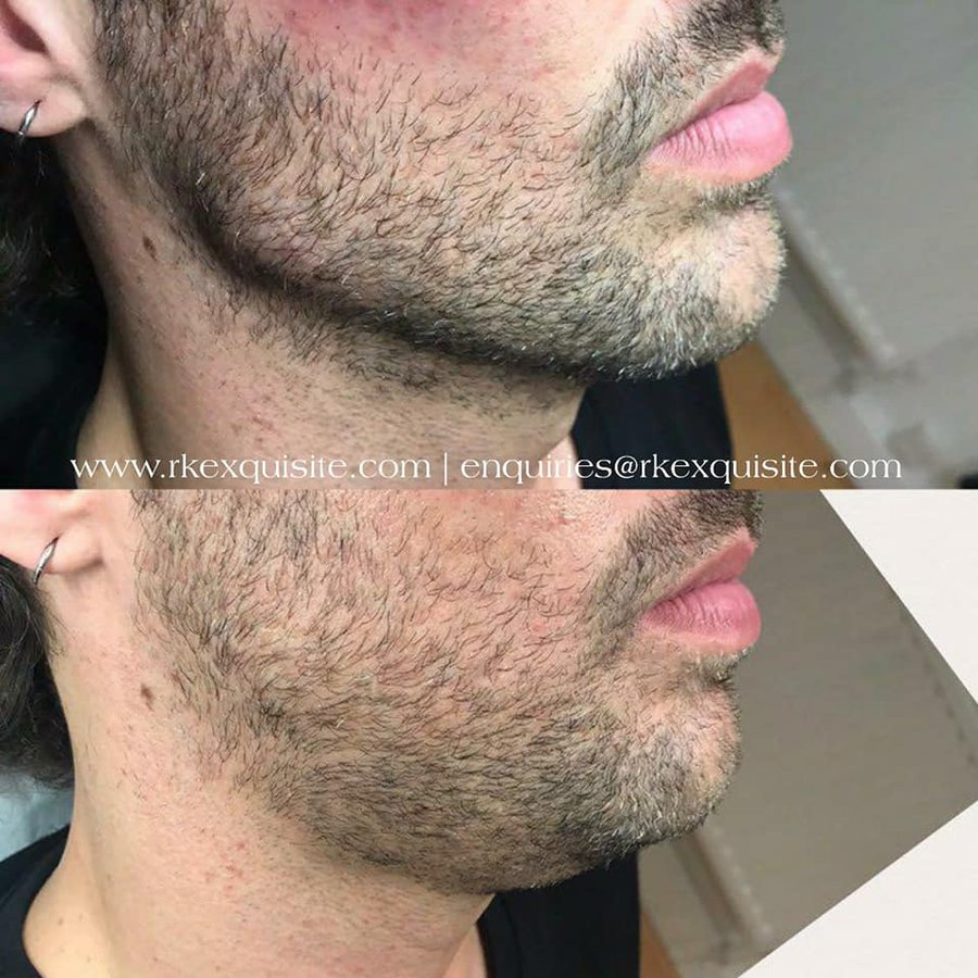 RK Exquisite - RK Exquisite