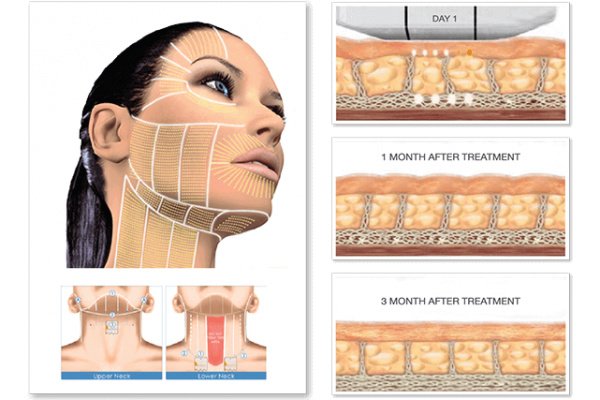 RK Exquisite - RK Exquisite
