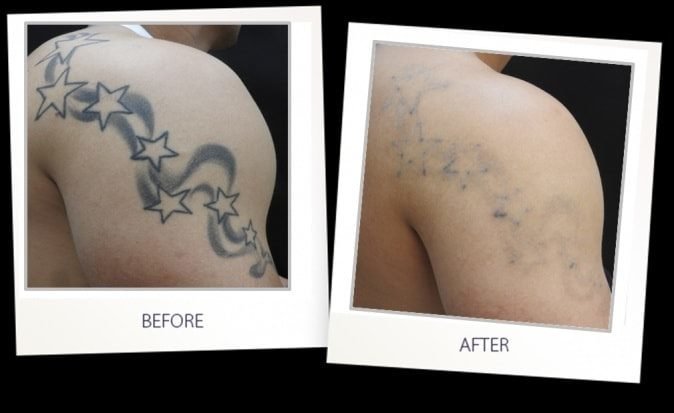 RK Exquisite - RK Exquisite