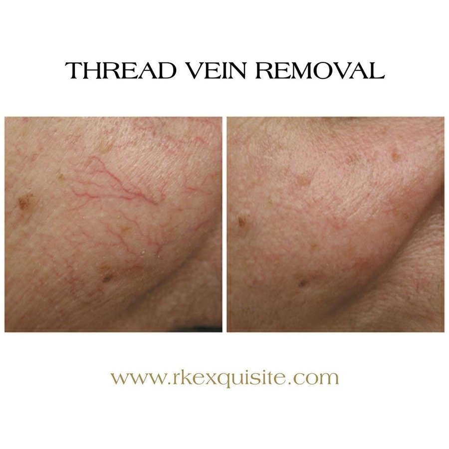 RK Exquisite - RK Exquisite