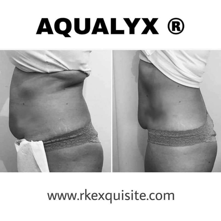 RK Exquisite - RK Exquisite