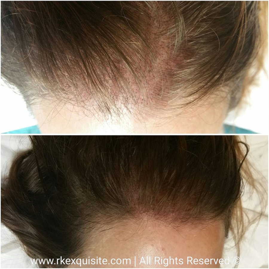 RK Exquisite - RK Exquisite