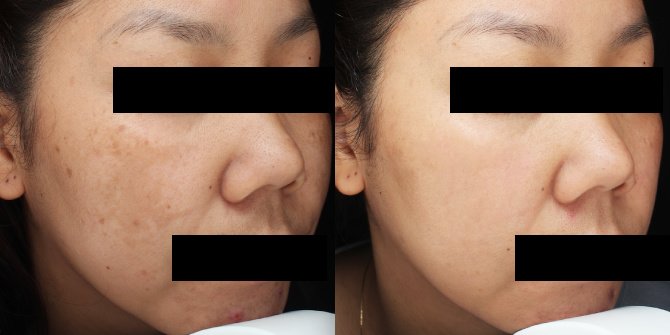 Rohto Aohal Clinic - Rohto Aohal Clinic