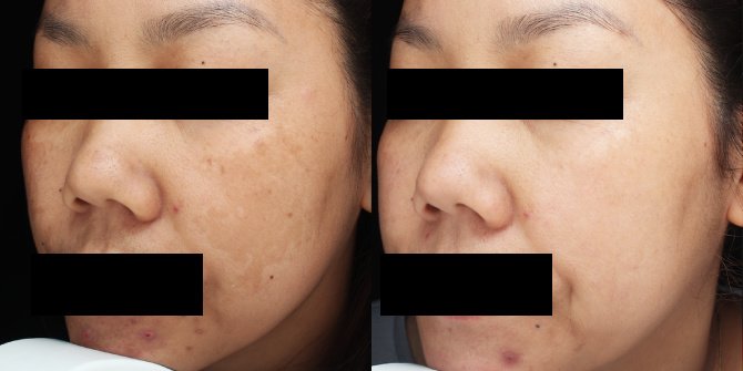 Rohto Aohal Clinic - Rohto Aohal Clinic