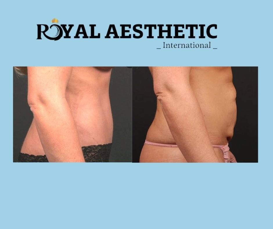 Royal Aesthetic International - Royal Aesthetic International