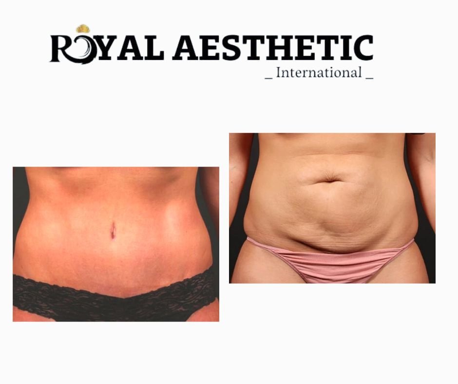 Royal Aesthetic International - Royal Aesthetic International