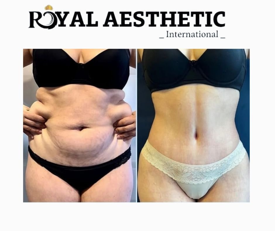 Royal Aesthetic International - Royal Aesthetic International