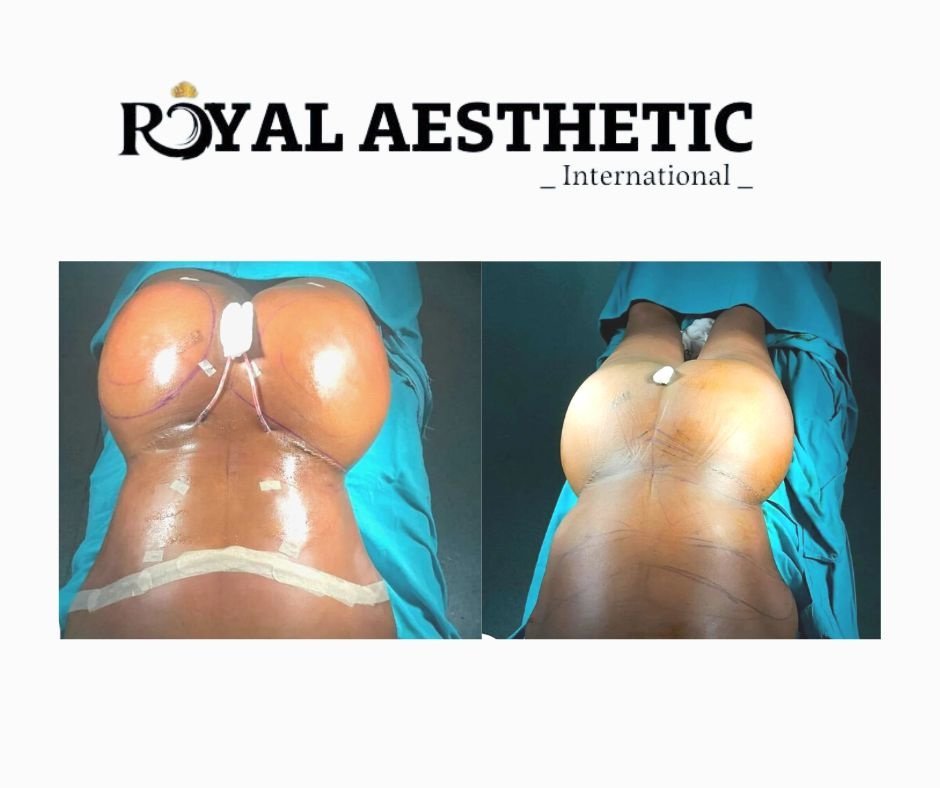 Royal Aesthetic International - Royal Aesthetic International