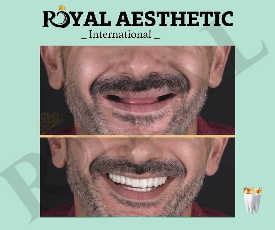 Royal Aesthetic International - Royal Aesthetic International